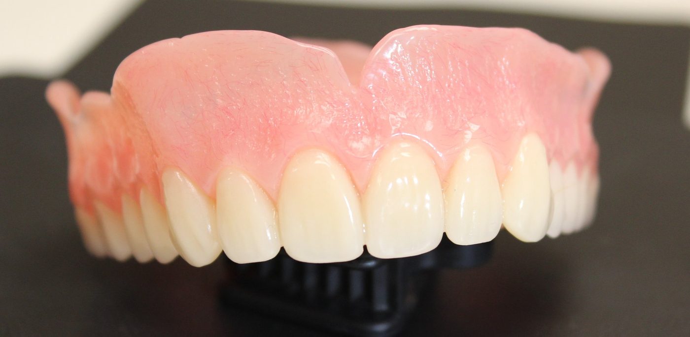 A completed denture from our partner laboratory